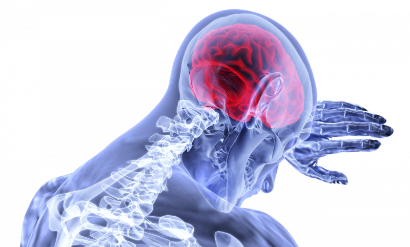 What You Need To Know About Traumatic Brain Injuries