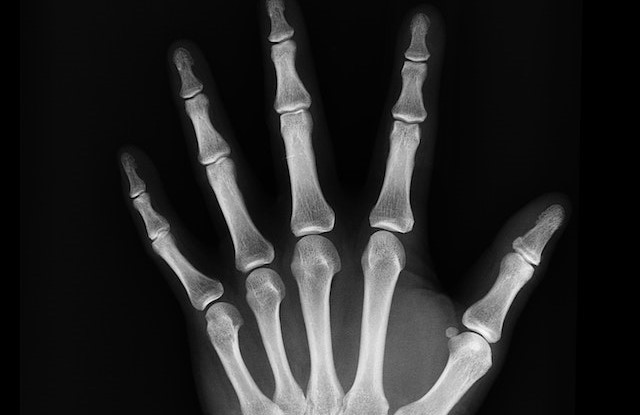 Facts About X-rays That You Never Knew